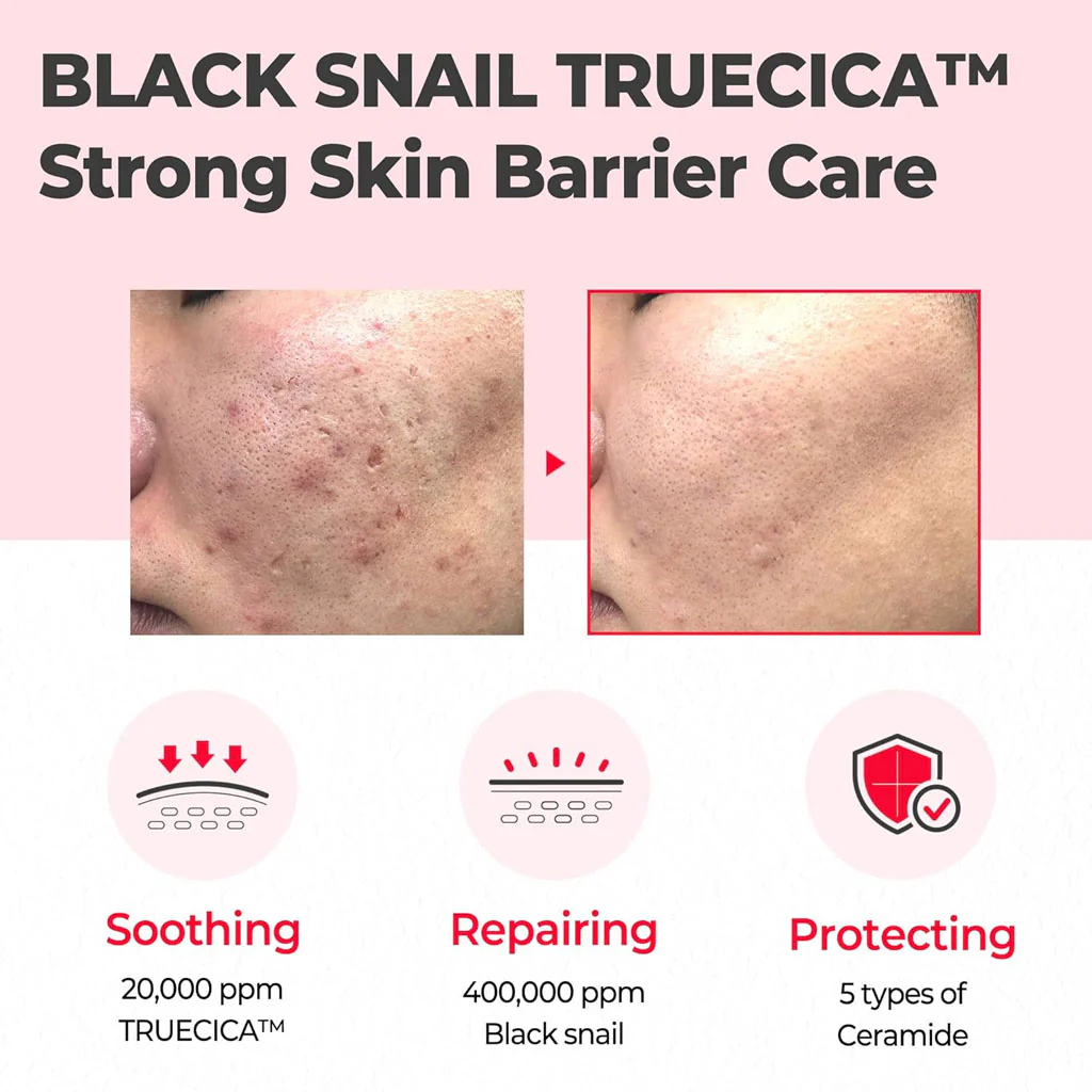 Snail Truecica Miracle Repair Cream - Image 3