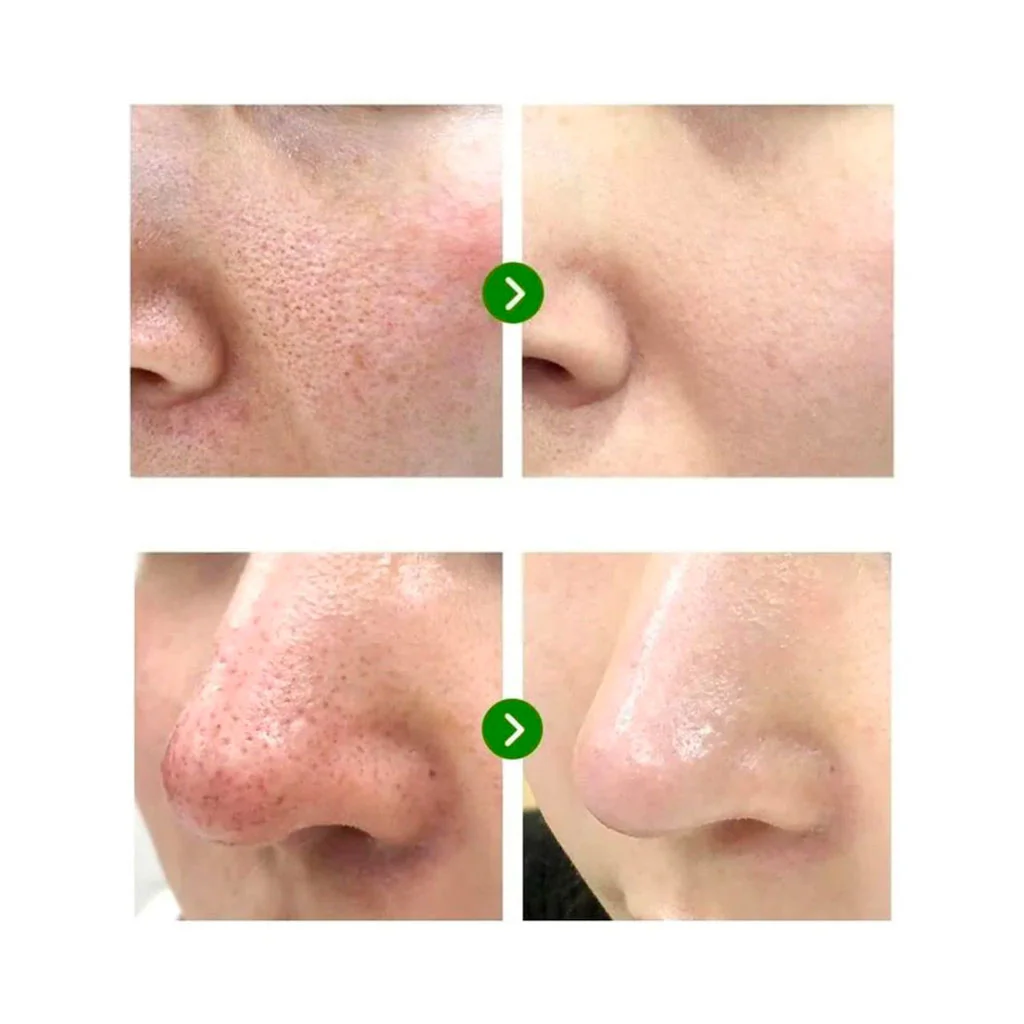 Super Matcha Pore Tightening Serum - Image 2