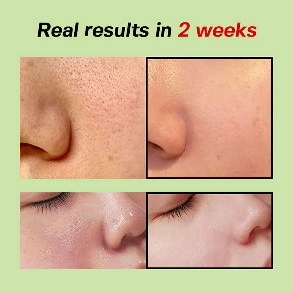 Green Tomato Pore Lifting Ampoule - Image 4
