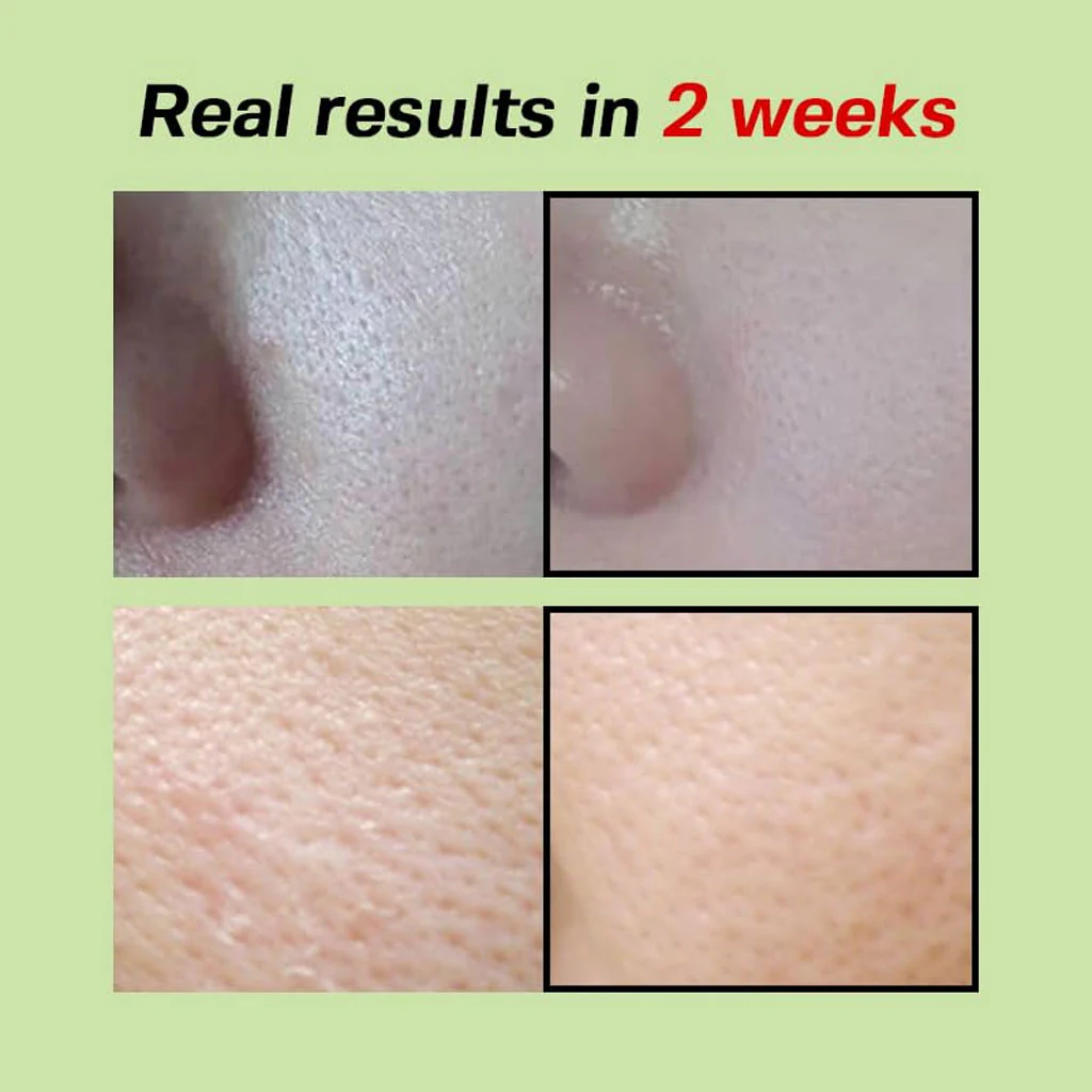 Green Tomato Pore Lifting Ampoule - Image 5