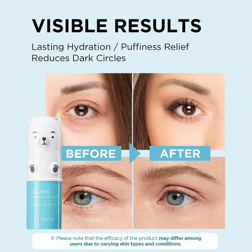 Iceland Hydrating Eye Stick - Image 2