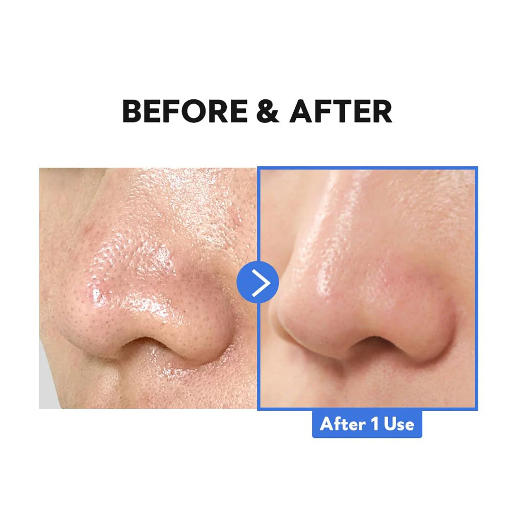 Hydro Boost Enzyme Cleansing Balm - Image 3