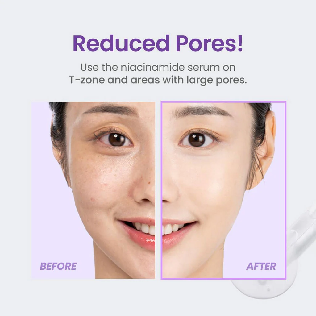 Niacinamide 20% Serum (30ml) - Image 3