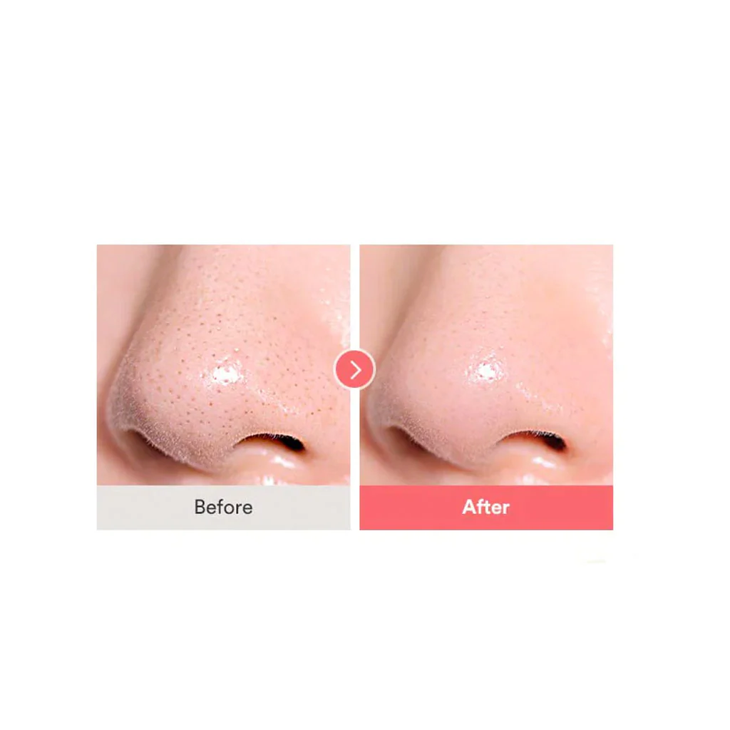 Calamine Pore Control Cleansing Oil - Image 3