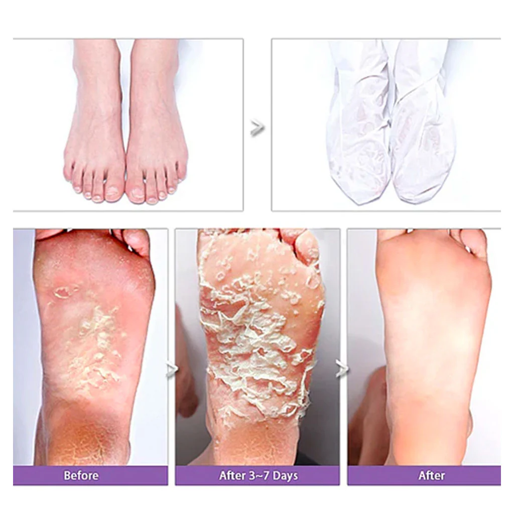 Shiny Foot Super Peeling Liquid - Image 2