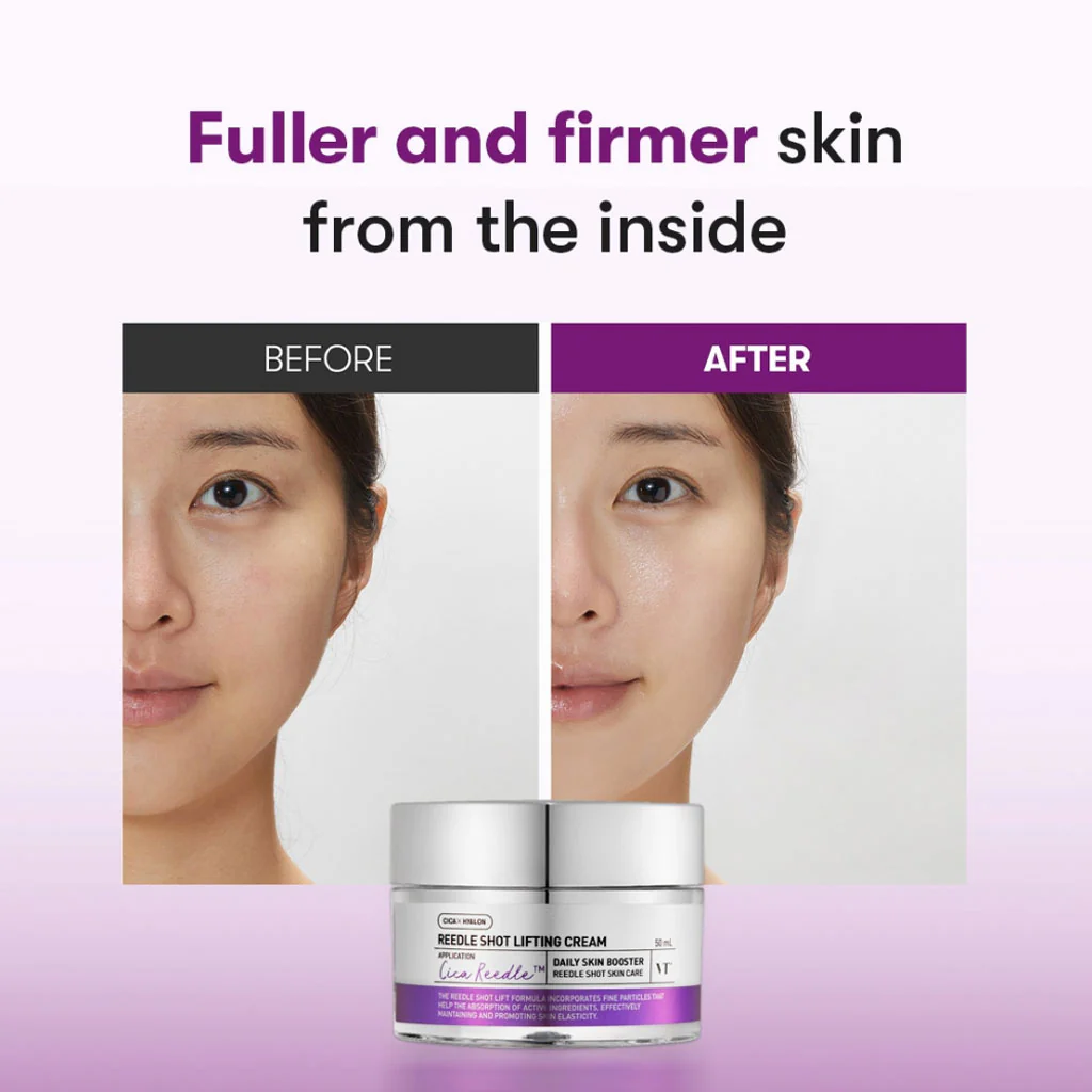 Reedle Shot Lifting Cream - Image 3